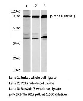 RPS6KA5 / MSK1 Antibody - Western blot of p-MSK1(Thr581) pAb in extracts from Jurkat, PC12 and Raw264.7 cells.