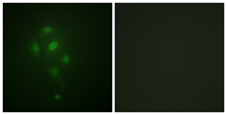 RPS6KA5 / MSK1 Antibody - Immunofluorescence analysis of A549 cells, using MSK1 (Phospho-Thr581) Antibody. The picture on the right is blocked with the phospho peptide.