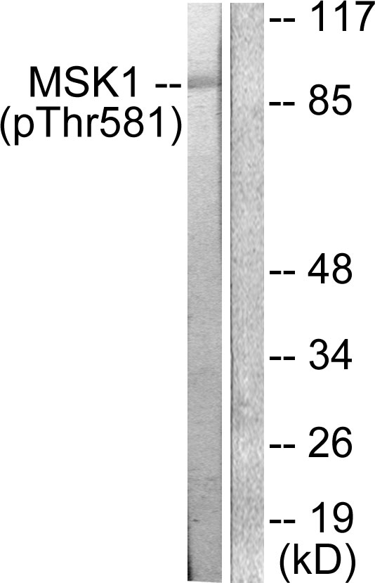 RPS6KA5 / MSK1 Antibody - Western blot analysis of lysates from RAW264.7 cells treated with UV 5', using MSK1 (Phospho-Thr581) Antibody. The lane on the right is blocked with the phospho peptide.