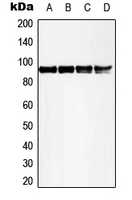 RPS6KA5 / MSK1 Antibody - Western blot analysis of MSK1 (pT581) expression in HeLa UV-treated (A); 293 UV-treated (B); SP2/0 UV-treated (C); rat liver (D) whole cell lysates.