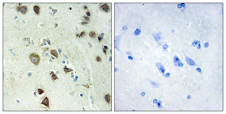RPS6KA6 / RSK4 Antibody - Immunohistochemistry analysis of paraffin-embedded human brain tissue, using S6K-alpha6 Antibody. The picture on the right is blocked with the synthesized peptide.