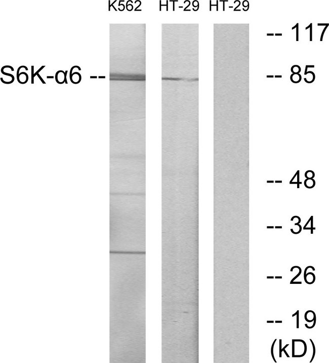 RPS6KA6 / RSK4 Antibody - Western blot analysis of lysates from K562 and HT-29 cells, using S6K-alpha6 Antibody. The lane on the right is blocked with the synthesized peptide.