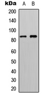 RPS6KA6 / RSK4 Antibody - Western blot analysis of RSK4 expression in HeLa (A); HepG2 (B) whole cell lysates.