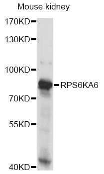 RPS6KA6 / RSK4 Antibody - Western blot analysis of extracts of mouse kidney, using RPS6KA6 antibody at 1:1000 dilution. The secondary antibody used was an HRP Goat Anti-Rabbit IgG (H+L) at 1:10000 dilution. Lysates were loaded 25ug per lane and 3% nonfat dry milk in TBST was used for blocking. An ECL Kit was used for detection and the exposure time was 10s.