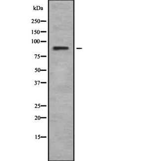 RPS6KA6 / RSK4 Antibody - Western blot analysis of Rsk-4 using K562 whole cells lysates