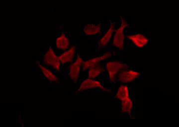 RPS6KA6 / RSK4 Antibody - Staining K562 cells by IF/ICC. The samples were fixed with PFA and permeabilized in 0.1% Triton X-100, then blocked in 10% serum for 45 min at 25°C. The primary antibody was diluted at 1:200 and incubated with the sample for 1 hour at 37°C. An Alexa Fluor 594 conjugated goat anti-rabbit IgG (H+L) Ab, diluted at 1/600, was used as the secondary antibody.