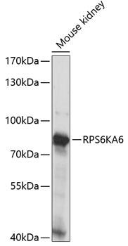 RPS6KA6 / RSK4 Antibody - Western blot analysis of extracts of mouse kidney using RPS6KA6 Polyclonal Antibody at dilution of 1:1000.