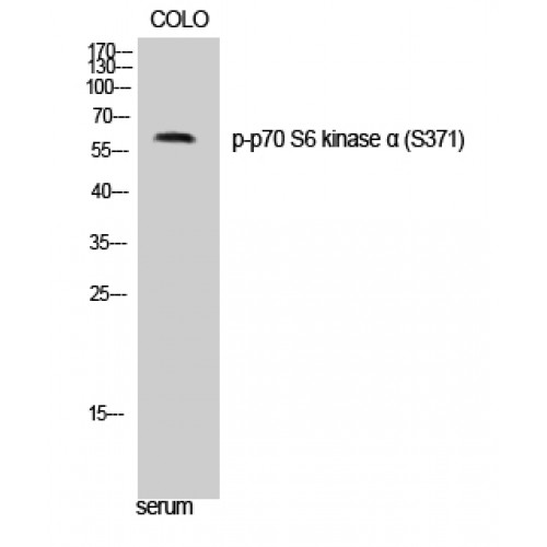 RPS6KB1 / P70S6K / S6K Antibody - Western blot of Phospho-p70 S6 kinase alpha (S371) antibody