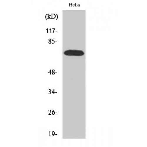 RPS6KB1 / P70S6K / S6K Antibody - Western blot of p70 S6 kinase alpha antibody