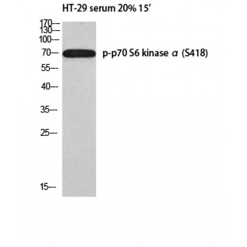RPS6KB1 / P70S6K / S6K Antibody - Western blot of Phospho-p70 S6 kinase alpha (S418) antibody
