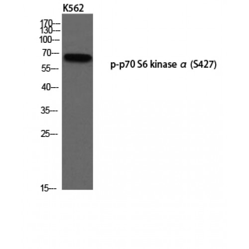 RPS6KB1 / P70S6K / S6K Antibody - Western blot of Phospho-p70 S6 kinase alpha (S427) antibody
