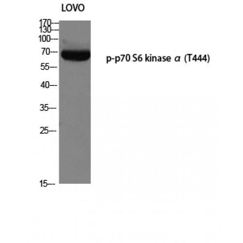 RPS6KB1 / P70S6K / S6K Antibody - Western blot of Phospho-p70 S6 kinase alpha (T444) antibody
