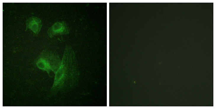 RPS6KB1 / P70S6K / S6K Antibody - Immunofluorescence analysis of HeLa cells, using p70 S6 Kinase Antibody. The picture on the right is blocked with the synthesized peptide.