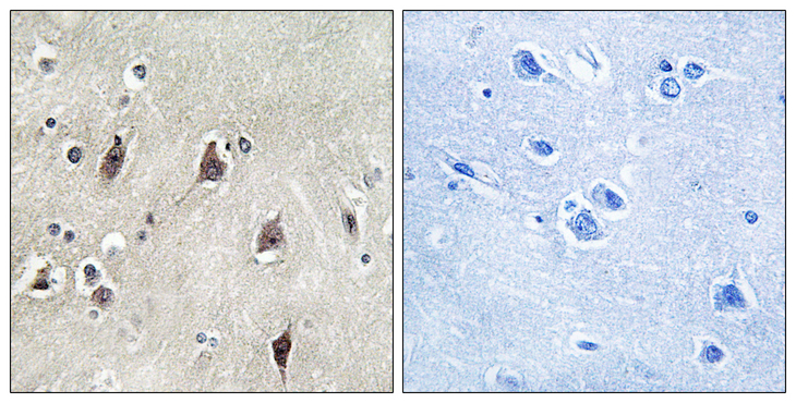 RPS6KB1 / P70S6K / S6K Antibody - Immunohistochemistry analysis of paraffin-embedded human brain tissue, using p70 S6 Kinase Antibody. The picture on the right is blocked with the synthesized peptide.