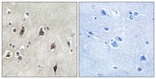 RPS6KB1 / P70S6K / S6K Antibody - Immunohistochemistry analysis of paraffin-embedded human brain tissue, using p70 S6 Kinase Antibody. The picture on the right is blocked with the synthesized peptide.
