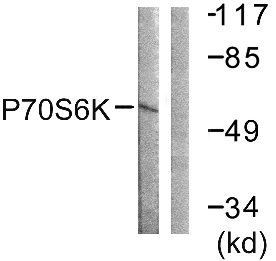 RPS6KB1 / P70S6K / S6K Antibody - Western blot analysis of lysates from Jurkat cells, using p70 S6 Kinase Antibody. The lane on the right is blocked with the synthesized peptide.