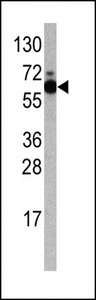 RPS6KB1 / P70S6K / S6K Antibody - Western blot of anti-RPS6KB1 Antibody antibody in Jurkat cell line lysates (35 ug/lane). RPS6KB1 Antibody )(arrow) was detected using the purified antibody.