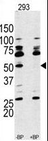 RPS6KB1 / P70S6K / S6K Antibody - Western blot of anti-RPS6KB1 Antibody antibody pre-incubated with and without blocking peptide (BP#NULL) in 293 cell line lysate. RPS6KB1 Antibody (arrow) was detected using the purified antibody.