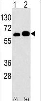 RPS6KB1 / P70S6K / S6K Antibody - Western blot of anti-RPS6KB1 Antibody antibody in 293 cell line lysates transiently transfected with the RPS6KB1 gene (2 ug/lane). RPS6KB1(arrow) was detected using the purified antibody.