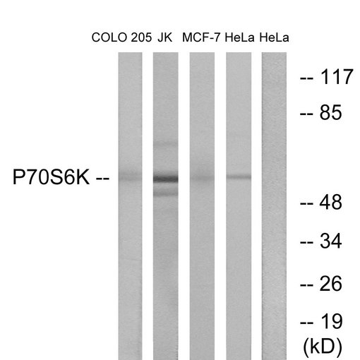 RPS6KB1 / P70S6K / S6K Antibody - Western blot analysis of lysates from COLO205, Jurkat, MCF-7, and HeLa cells, using p70 S6 Kinase Antibody. The lane on the right is blocked with the synthesized peptide.