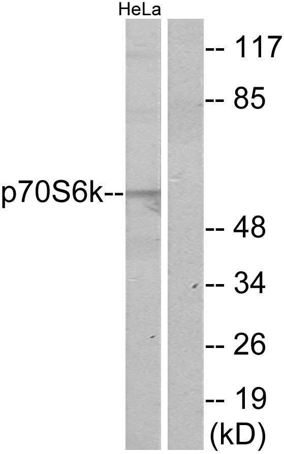 RPS6KB1 / P70S6K / S6K Antibody - Western blot analysis of lysates from HeLa cells, using p70 S6 Kinase Antibody. The lane on the right is blocked with the synthesized peptide.