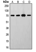 RPS6KB1 / P70S6K / S6K Antibody - Western blot analysis of S6K1 expression in MCF7 (A); HeLa (B); MDCK (C); mouse brain (D) whole cell lysates.