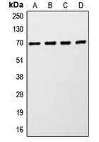 RPS6KB1 / P70S6K / S6K Antibody - Western blot analysis of S6K1 expression in MCF7 (A); HeLa (B); HEK293 (C); mouse brain (D) whole cell lysates.