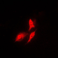 RPS6KB1 / P70S6K / S6K Antibody - Immunofluorescent analysis of S6K1 staining in HeLa cells. Formalin-fixed cells were permeabilized with 0.1% Triton X-100 in TBS for 5-10 minutes and blocked with 3% BSA-PBS for 30 minutes at room temperature. Cells were probed with the primary antibody in 3% BSA-PBS and incubated overnight at 4 C in a humidified chamber. Cells were washed with PBST and incubated with a DyLight 594-conjugated secondary antibody (red) in PBS at room temperature in the dark. DAPI was used to stain the cell nuclei (blue).
