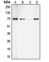 RPS6KB1 / P70S6K / S6K Antibody - Western blot analysis of S6K1 expression in HeLa (A); HEK293 (B); MDCK (C); mouse brain (D) whole cell lysates.