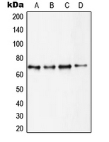 RPS6KB1 / P70S6K / S6K Antibody - Western blot analysis of S6K1 expression in MCF7 (A); HEK293 (B); MDCK (C); mouse brain (D) whole cell lysates.