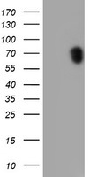 RPS6KB1 / P70S6K / S6K Antibody - HEK293T cells were transfected with the pCMV6-ENTRY control (Left lane) or pCMV6-ENTRY RPS6KB1 (Right lane) cDNA for 48 hrs and lysed. Equivalent amounts of cell lysates (5 ug per lane) were separated by SDS-PAGE and immunoblotted with anti-RPS6KB1.