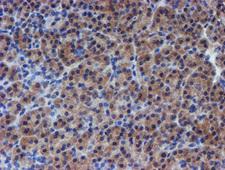 RPS6KB1 / P70S6K / S6K Antibody - IHC of paraffin-embedded Human pancreas tissue using anti-RPS6KB1 mouse monoclonal antibody. (Heat-induced epitope retrieval by 10mM citric buffer, pH6.0, 100C for 10min).