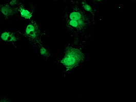 RPS6KB1 / P70S6K / S6K Antibody - Anti-RPS6KB1 mouse monoclonal antibody immunofluorescent staining of COS7 cells transiently transfected by pCMV6-ENTRY RPS6KB1.