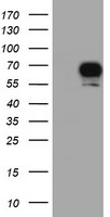 RPS6KB1 / P70S6K / S6K Antibody - HEK293T cells were transfected with the pCMV6-ENTRY control (Left lane) or pCMV6-ENTRY RPS6KB1 (Right lane) cDNA for 48 hrs and lysed. Equivalent amounts of cell lysates (5 ug per lane) were separated by SDS-PAGE and immunoblotted with anti-RPS6KB1.