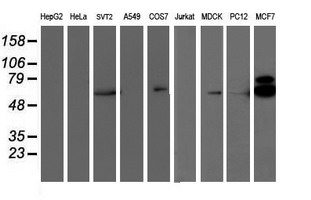 RPS6KB1 / P70S6K / S6K Antibody - Western blot of extracts (35 ug) from 9 different cell lines by using anti-RPS6KB1 monoclonal antibody.