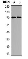 RPS6KB1 / P70S6K / S6K Antibody - Western blot analysis of S6K1 expression in HeLa (A); HepG2 (B) whole cell lysates.
