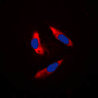 RPS6KB1 / P70S6K / S6K Antibody - Immunofluorescent analysis of S6K1 staining in HeLa cells. Formalin-fixed cells were permeabilized with 0.1% Triton X-100 in TBS for 5-10 minutes and blocked with 3% BSA-PBS for 30 minutes at room temperature. Cells were probed with the primary antibody in 3% BSA-PBS and incubated overnight at 4 deg C in a humidified chamber. Cells were washed with PBST and incubated with a DyLight 594-conjugated secondary antibody (red) in PBS at room temperature in the dark. DAPI was used to stain the cell nuclei (blue).