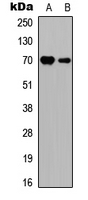 RPS6KB1 / P70S6K / S6K Antibody - Western blot analysis of S6K1 expression in Jurkat (A); mouse brain (B) whole cell lysates.
