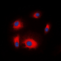 RPS6KB1 / P70S6K / S6K Antibody - Immunofluorescent analysis of S6K1 staining in Jurkat cells. Formalin-fixed cells were permeabilized with 0.1% Triton X-100 in TBS for 5-10 minutes and blocked with 3% BSA-PBS for 30 minutes at room temperature. Cells were probed with the primary antibody in 3% BSA-PBS and incubated overnight at 4 deg C in a humidified chamber. Cells were washed with PBST and incubated with a DyLight 594-conjugated secondary antibody (red) in PBS at room temperature in the dark. DAPI was used to stain the cell nuclei (blue).