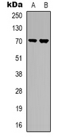 RPS6KB1 / P70S6K / S6K Antibody - Western blot analysis of S6K1 expression in HepG2 (A); Jurkat (B) whole cell lysates.