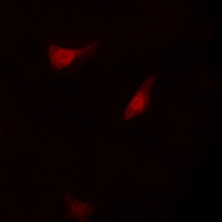 RPS6KB1 / P70S6K / S6K Antibody - Immunofluorescent analysis of S6K1 staining in HepG2 cells. Formalin-fixed cells were permeabilized with 0.1% Triton X-100 in TBS for 5-10 minutes and blocked with 3% BSA-PBS for 30 minutes at room temperature. Cells were probed with the primary antibody in 3% BSA-PBS and incubated overnight at 4 deg C in a humidified chamber. Cells were washed with PBST and incubated with a DyLight 594-conjugated secondary antibody (red) in PBS at room temperature in the dark. DAPI was used to stain the cell nuclei (blue).