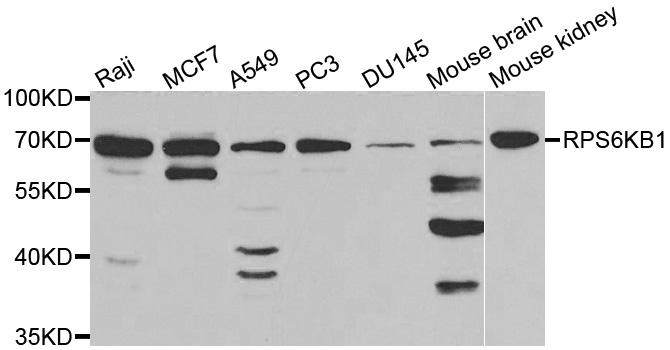 RPS6KB1 / P70S6K / S6K Antibody - Western blot analysis of extracts of various cell lines.