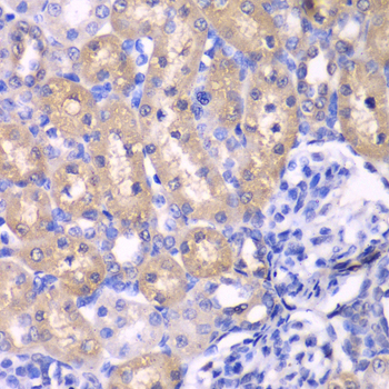 RPS6KB1 / P70S6K / S6K Antibody - Immunohistochemistry of paraffin-embedded rat kidney tissue.