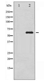 RPS6KB1 / P70S6K / S6K Antibody - Western blot of p70 S6 Kinase expression in Jurkat whole cell lysates,The lane on the left is treated with the antigen-specific peptide.