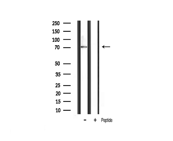 RPS6KB1 / P70S6K / S6K Antibody - Western blot analysis of p70 S6 Kinase expression in mouse muscle tissue lysates. The lane on the right is treated with the antigen-specific peptide.
