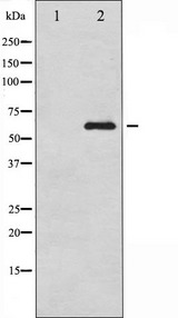 RPS6KB1 / P70S6K / S6K Antibody - Western blot analysis of p70 S6 Kinase expression in Jurkat whole cells lysates. The lane on the left is treated with the antigen-specific peptide.