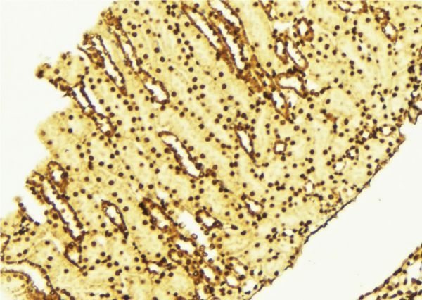 RPS6KB1 / P70S6K / S6K Antibody - 1:100 staining human gastric tissue by IHC-P. The sample was formaldehyde fixed and a heat mediated antigen retrieval step in citrate buffer was performed. The sample was then blocked and incubated with the antibody for 1.5 hours at 22°C. An HRP conjugated goat anti-rabbit antibody was used as the secondary.