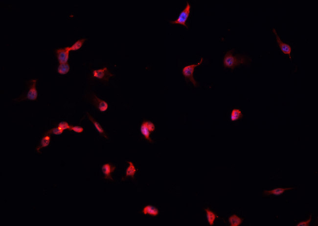 RPS6KB1 / P70S6K / S6K Antibody - Staining NIH-3T3 cells by IF/ICC. The samples were fixed with PFA and permeabilized in 0.1% Triton X-100, then blocked in 10% serum for 45 min at 25°C. The primary antibody was diluted at 1:200 and incubated with the sample for 1 hour at 37°C. An Alexa Fluor 594 conjugated goat anti-rabbit IgG (H+L) Ab, diluted at 1/600, was used as the secondary antibody.