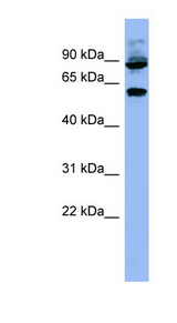 RPS6KB1 / P70S6K / S6K Antibody - RPS6KB1 / S6K antibody Western blot of HeLa lysate. This image was taken for the unconjugated form of this product. Other forms have not been tested.