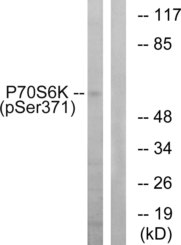 RPS6KB1 / P70S6K / S6K Antibody - Western blot analysis of lysates from COLO205 cells treated with serum 20% 15', using p70 S6 Kinase (Phospho-Ser371) Antibody. The lane on the right is blocked with the phospho peptide.